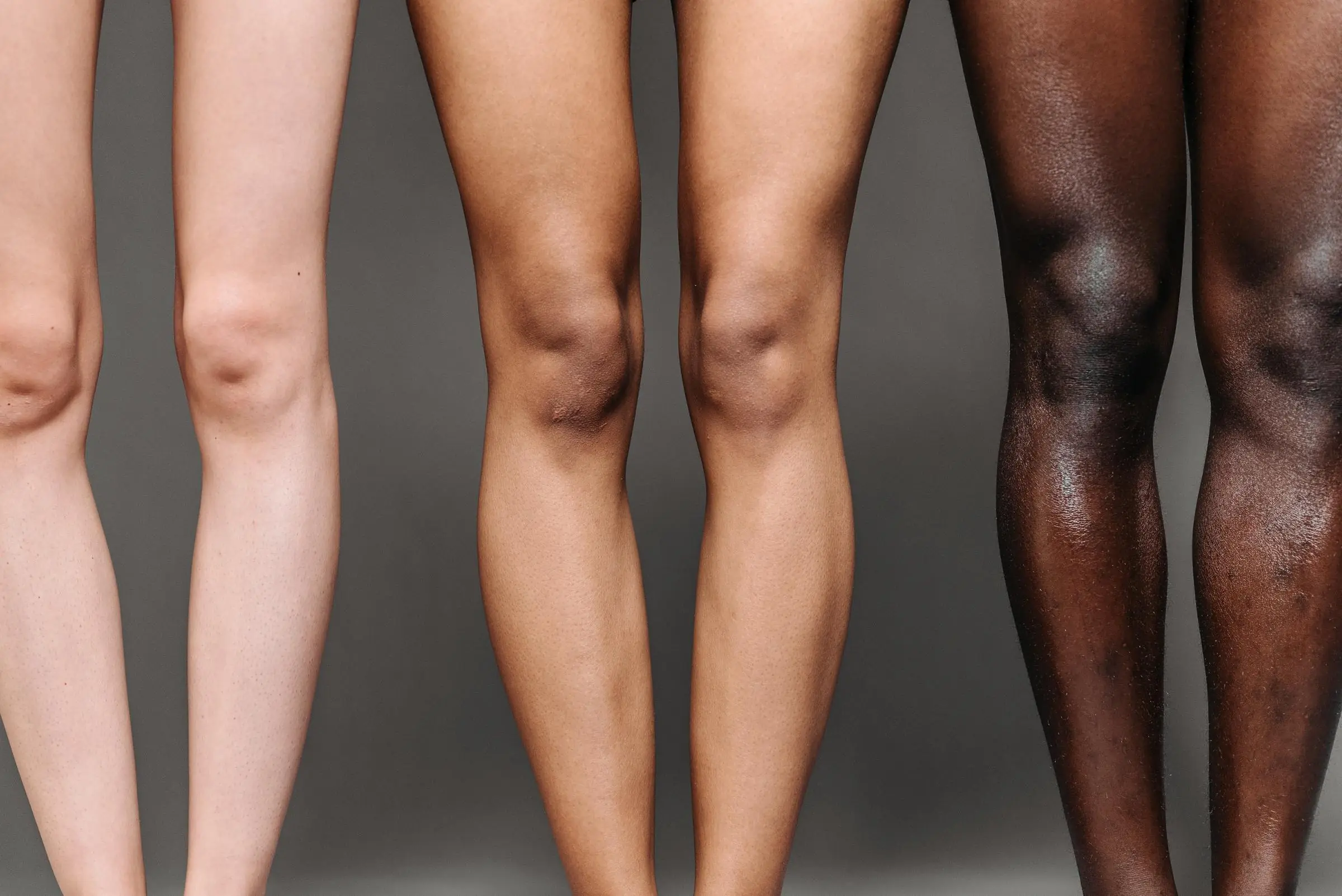Arthritis in the Legs