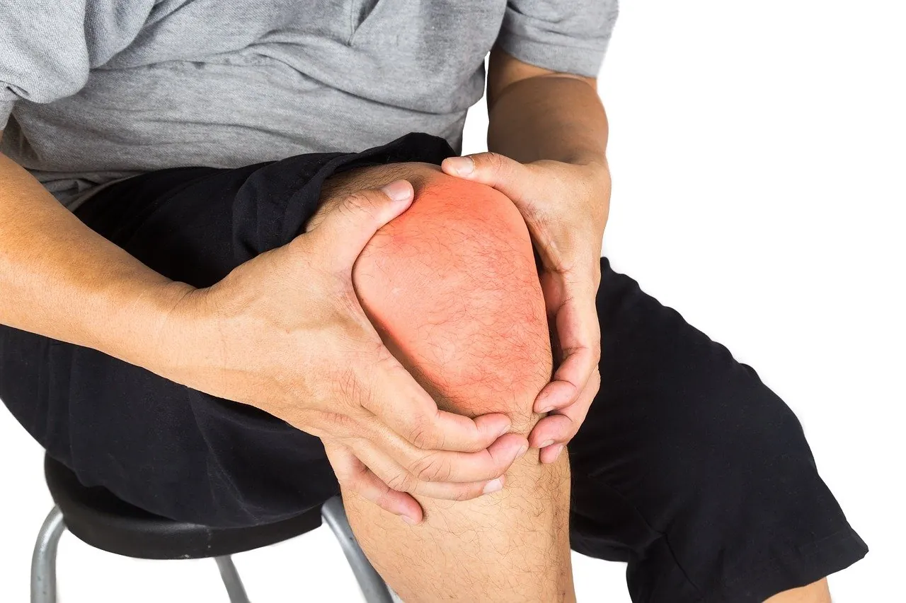 Arthritis in the Legs