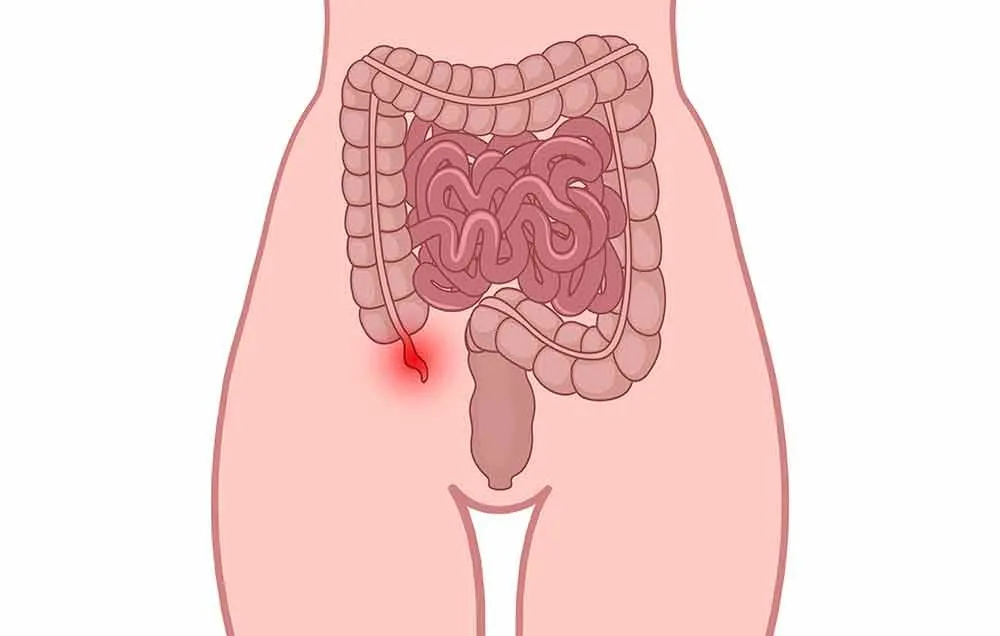 Appendix
